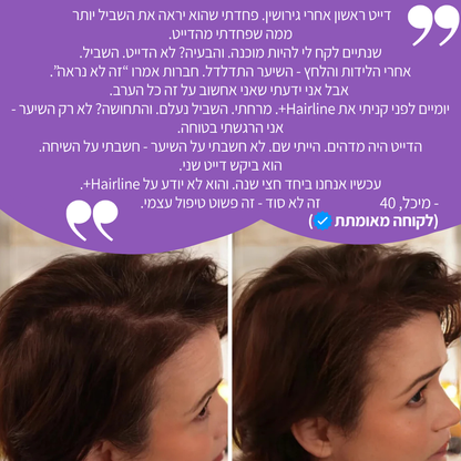 פודרה למילוי קו השיער מבית אלוורה hairline+