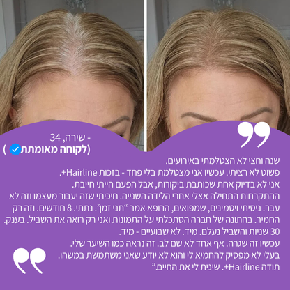 פודרה למילוי קו השיער מבית אלוורה hairline+