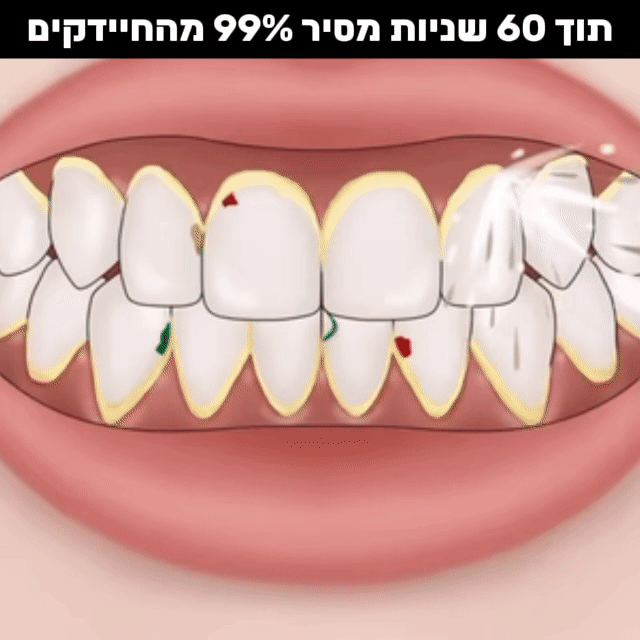 ניקוי שיניים מים 4 ב 1-Water flosser pro