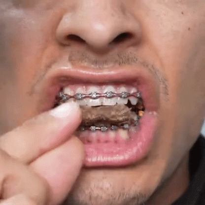 ניקוי שיניים מים 4 ב 1-Water flosser pro